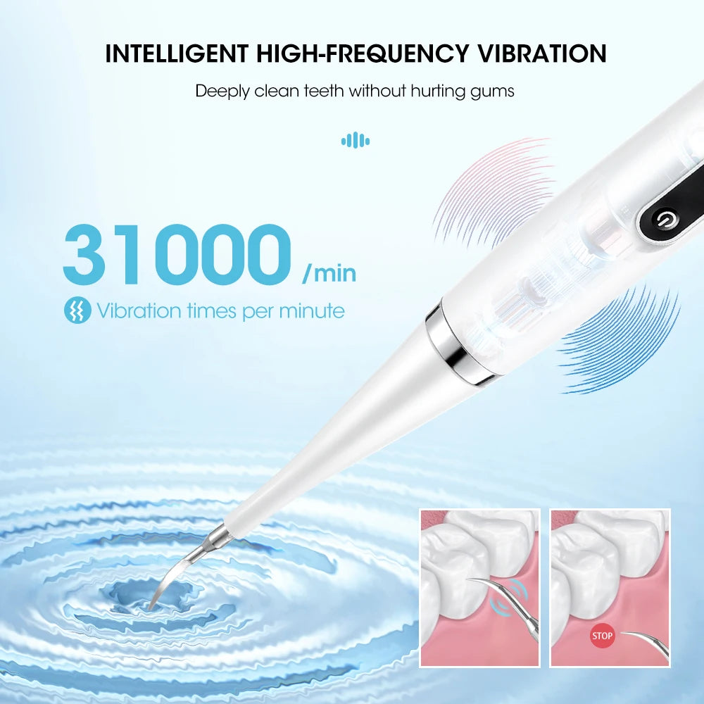 Electric Toothbrush